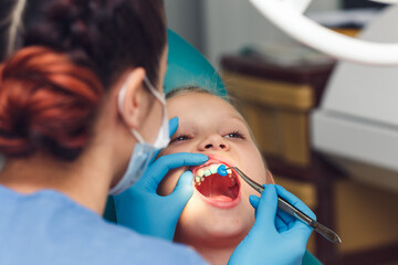 Understanding How Fluoride Works: Your Child’s Dental Defender